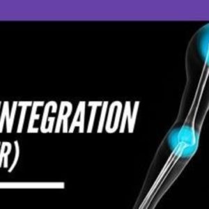 MPI Integration Upper