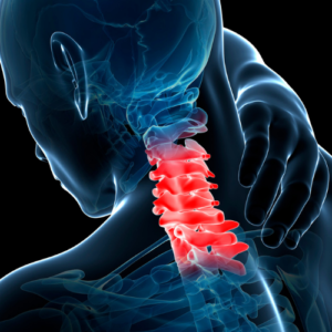 Cervical Instability Masterclass