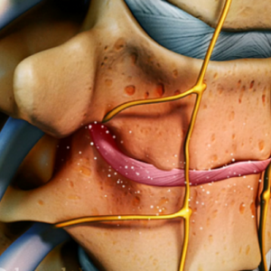 The Disc Masterclass