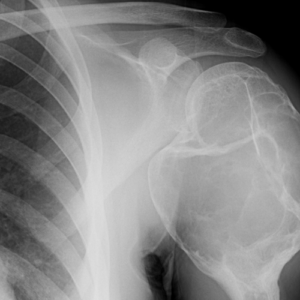 Radiology Masterclass | Imaging of Spinal Surgery and Vertebroplasty | Dr. Inger Roug DC (on demand)