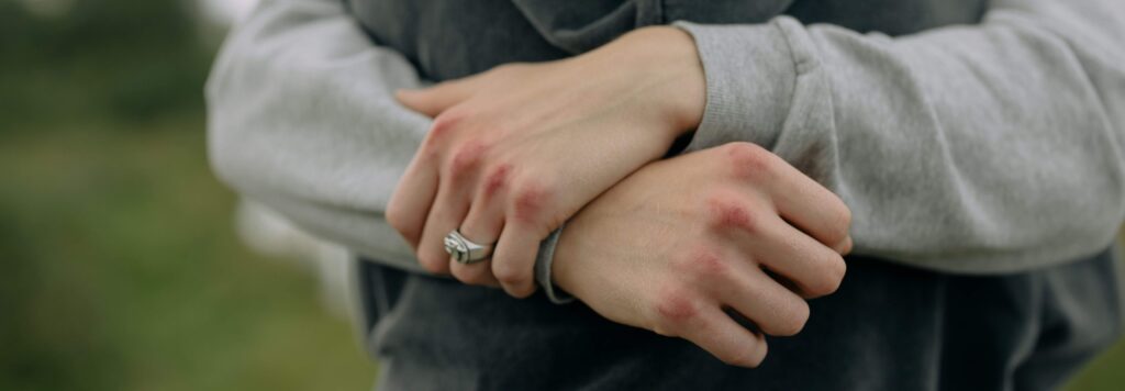 verlatingsangst-controle